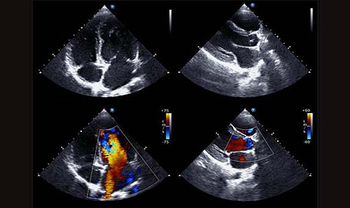 Cardiology