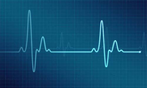 Electrocardiography